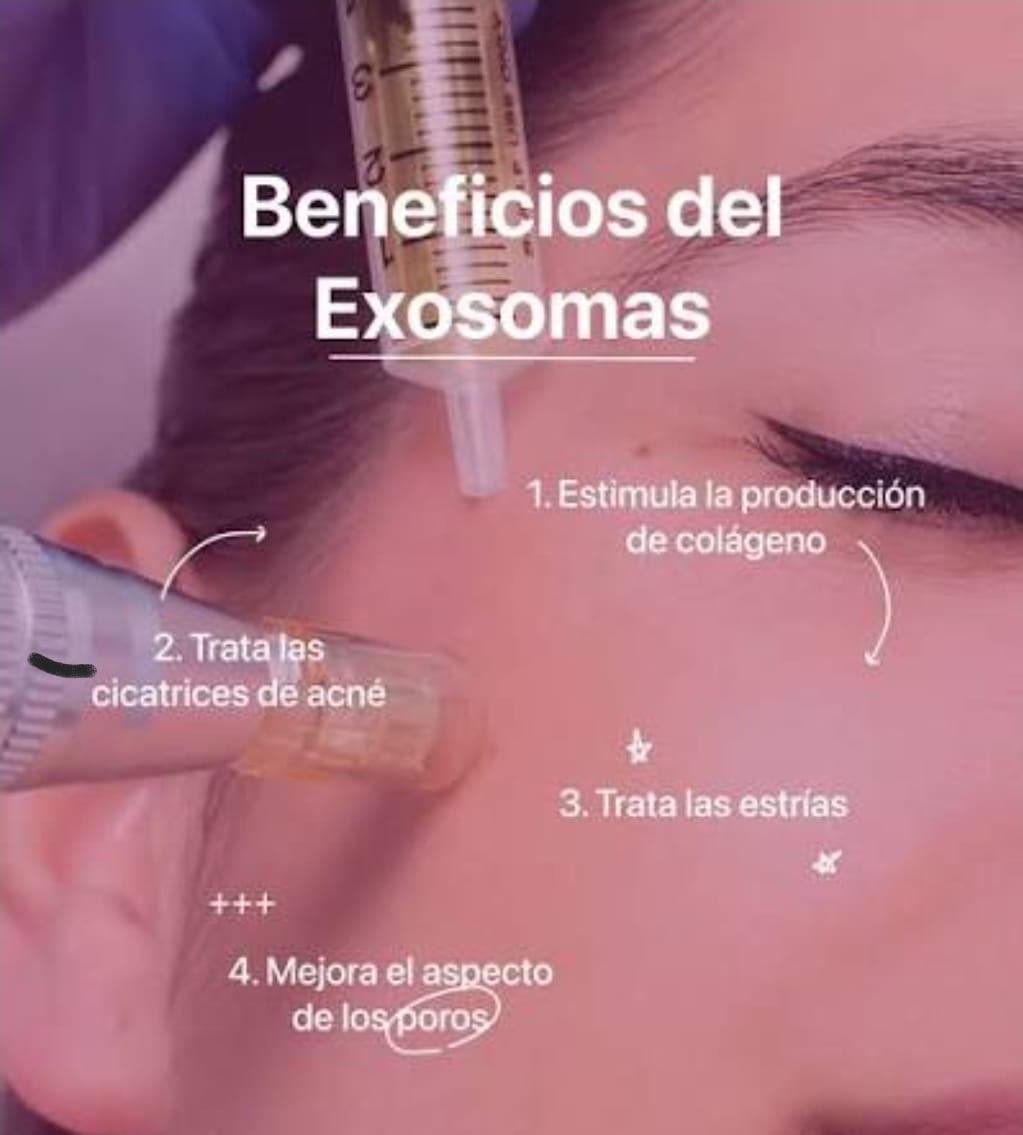 Exosomas, PDRN del Salmon y Células Madre